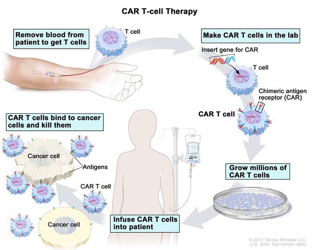 CAR T-cell therapy manufacturing process
