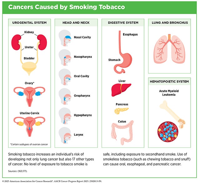 Smoking tobacco increase the risk of 17 other cancer types besides lung cancer, including those found in the urogenital system, head and neck, digestive system, and hematopoietic system. 